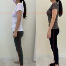 시너제틱스 재활교정 전문센터 | 수성동 대기구 리브 필라테스 /재활교정 전문센터] 산후 필라테스후기사진 산후 아랫배가 안 들어가는...