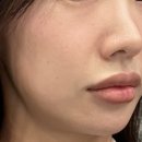 (주)에그메디 | 메디힐 마데카소사이드 더마 크림 팩 클렌저 / 팩과 클렌징폼을 한번에 간편한 홈케어 꿀템