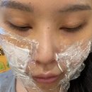 하고 | 노원 피부과추천 인모드 슈링크 같이 하고 온 후기 전후차이 사진 O