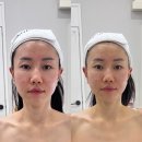 케이엠프라이빗 | 천안 불당동 웨딩관리 케이엠에스테틱 윤곽관리 후기