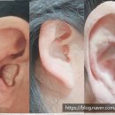 오티콘보청기도봉점 이미지