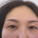 르네브로우 이미지