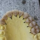 경북치과기공소 이미지