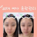 수다피부관리실 | 별내 갈매 피부관리실 뷰티엔제이 윤곽테라피 후기 리프팅부터 윤곽관리까지 안 아프게 성공! 구리...