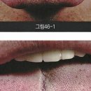 열문