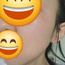 보템 | 보템 알페이스 내돈내산 효과 사용방법 탄력관리 출력 고주파 마사지기 디바이스 추천