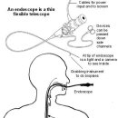 위내시경(Gastroscopy)란? 이미지