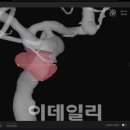 뉴로메디 이미지