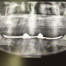 참진치과기공소 이미지