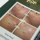 트로이온 | 창원 상남동 1:1 맞춤 피부관리 282에스테틱 약초필링 트로이필 후기