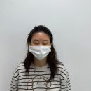 대구동신초등학교 | M자 탈모 헤어라인, 감추지말고 자신 있게 바꿔보세요! 바람부는날도 당당하게