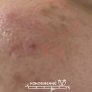 피브엔의원 | 피브엔의원 1일차 후기