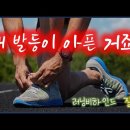 러닝으로 인한 정강이등 통증에 대한 고찰!(신스프린트 통증 극복기) 이미지