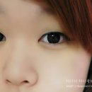 티탑콘텍트 이미지