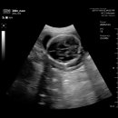 지엠메디칼 이미지