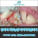 힐링힐스 동물 치과병원 | 강아지 치주농양으로부터 발치안하고 치아살리기 [강아지치과] - 힐링힐스동물치과병원