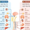 자율신경 실조증의 원인 이미지