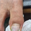 칠곡네일 | 대구 달서구 칠곡 발톱무좀 깨끗하게 관리 잘하는 네일바이엘 후기