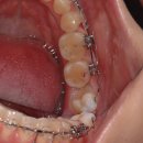 가지런이치과교정과치과의원 이미지