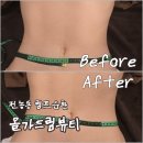 순환 | [리뷰] 전농동바디관리 올가드림뷰티 림프순환관리 후기