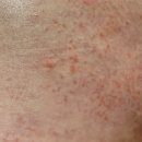 쌩쌩한의원 | 임신일기 | 임신 12주-18주 증상과 부산 니프티검사 가격 저렴한 곳, 16주 정기검진 및 젠더리빌 이벤트