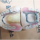 RPD치과기공소 이미지