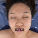 동탄 문제성피부 관리 헤르티움 방문 후기