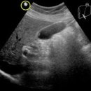 복부초음파 검사로 알 수 있는 것들 이미지