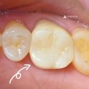 이프라임치과기공소 이미지