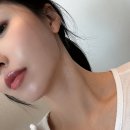 디어멍 | 세로 목주름 시술 디어넥주사 피부과 후기