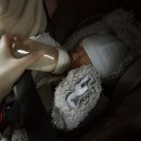 딤플 | 신생아 엉덩이 딤플 초음파 검사 후기