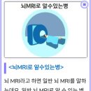 뇌 MRI로 알수 있는 병 이미지