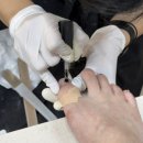 렌즈미범계점 | 범계패디 추천 문제성발톱 부러진발톱 관리는 엠빌리지네일!