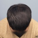 디에스엠피 이미지