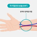 남원안과의원 | 인공신장실 근무 후기(1)