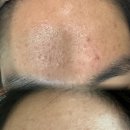 아쿠아스킨케어 이미지