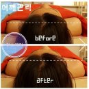 진스케어 이미지