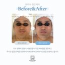 인트로맨즈 네이버블로그