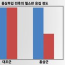 협심증 증상, 원인 막으려면 이렇게! 이미지