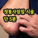 13년 알레르기·12년 습진·구강 궤양, 정통사암침법 치료 후기 (제202회) 이미지