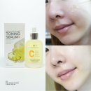 박하약국 | 박하선 세럼 이엘티 비타민 미백세럼, 청담 피부과 약국 입점템! 속건조 잡고 기미 순삭한 2주 찐 후기~