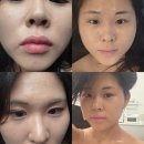 (주)벨벳케어 | [서울/마곡] 마곡 피부관리 <라인메이드스킨케어> 맞춤관리 받고 피부결 좋아진 후기 | 아토피 피부...
