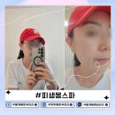 월계동 피부관리 피생몽스파에서 여행 후 자외선에 손상된 피부 진정&amp;속건조 수분 케어 후기
