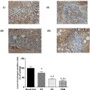 Re:아마씨유의 항암효과 Nature 논문 이미지