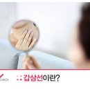 이유없이 피곤하고 예민하다면? '갑상선 질환' 바로 알기 이미지