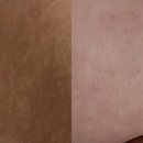 맑은세상피부과의원 이미지