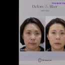 닥터뉴셀의원 | [강남역 강남 피부과 추천] 닥터뉴셀의원 강남본점 닥터뉴셀 피부과 추천