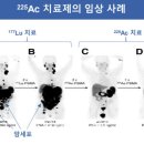뉴바이오팜 이미지