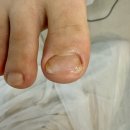 다시온 리케어 이미지