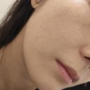 레디피부과의원 이미지